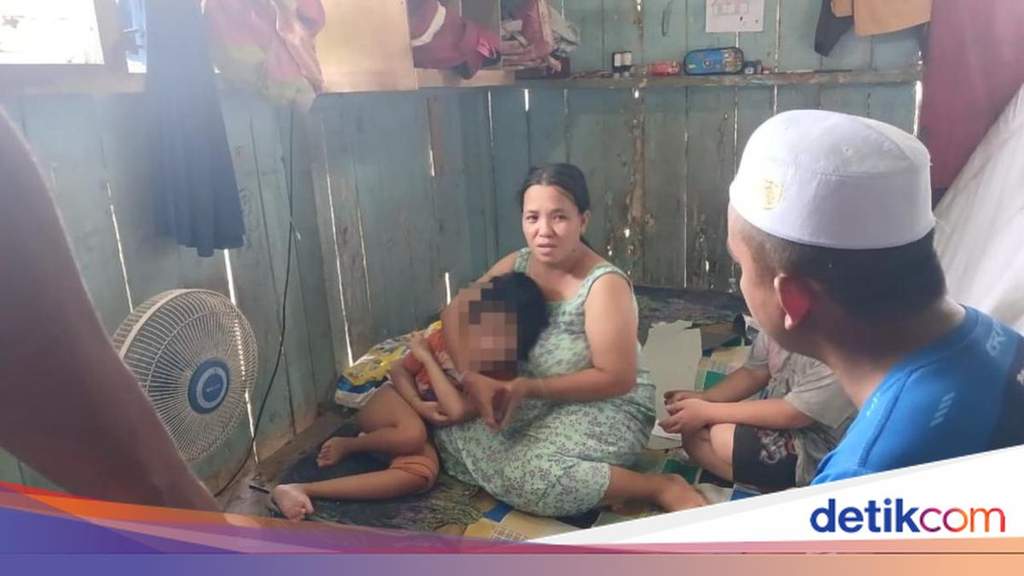 Kondisi Danisa, bocah disabilitas di Samarinda yang terbaring setelah mengalami patah tulang kaki
